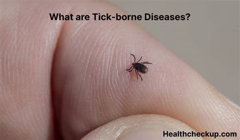 Tick Borne Diseases Symptoms Diagnosis Treatment Prevention