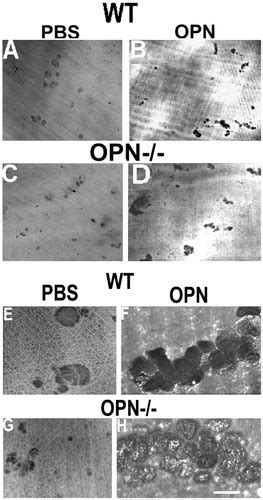 Osteopontin Deficiency Produces Osteoclast Dysfunction Due To Reduced