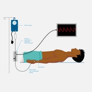 Non Invasive Blood Pressure Measurement Philips Healthcare