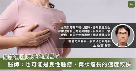 乳房出現腫塊不一定是乳癌！「乳房葉狀瘤」長速度快怎麼辦？ Heho 健康（台灣） Line Today