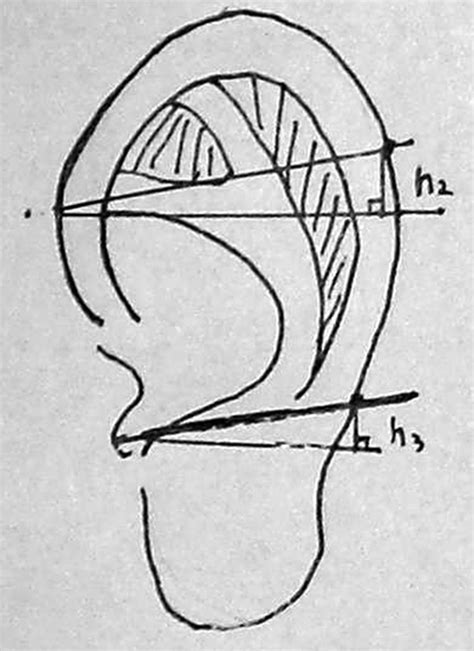 Auricular Reconstruction Using A Novel Three Flap Technique Improves