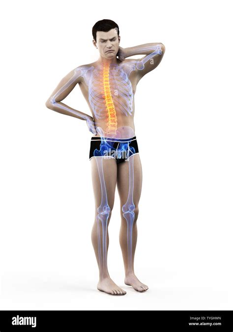 3d Rendered Medically Accurate Illustration Of A Man Having A Backache