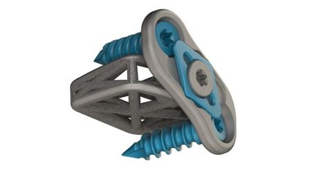 Fda Clears Web Medical S New Integrated Cervical Plate Orthopedic