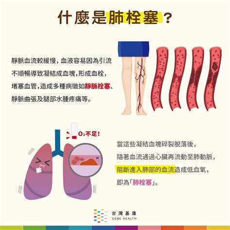 常常胸痛、呼吸急促？一分鐘帶你快速了解肺栓塞！