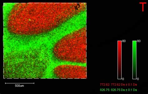 MALDI Mass Spectrometry Imaging Of Lipids In Positive And Negative Ion