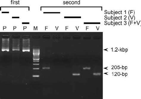 Nested Pcr Assay For The Detection Of P Falciparum And P Vivax The