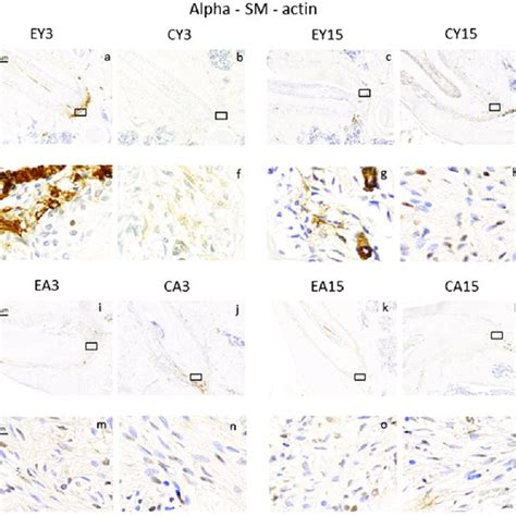 Immunohistochemical Staining For Alpha Smooth Muscle Actin In The Download Scientific Diagram