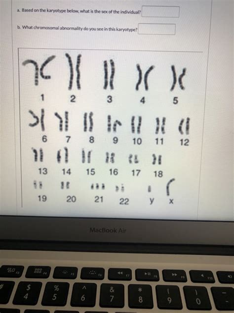 Solved A Based On The Karyotype Below What Is The Sex Of Chegg