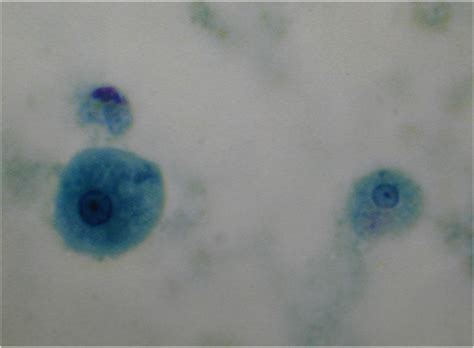 Microbiology Module Flashcards Quizlet