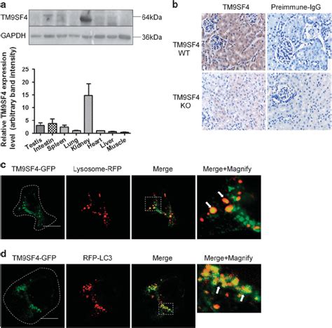 Tissue Distribution And Subcellular Localization Of Tm9sf4 Proteins Download Scientific