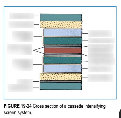 Diagram Of Radiography Lecture 5 Cross Section Of Cassette Diagram