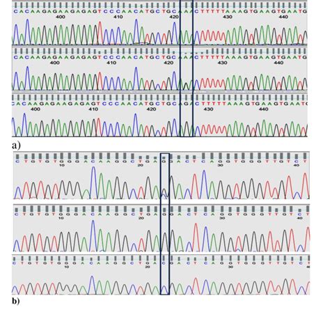 A Sanger Sequencing Chromatogram Generated By Abi Genetic Analyzer