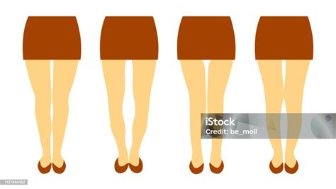 Vector Illustration With Different Shapes Of Women Legs Stock