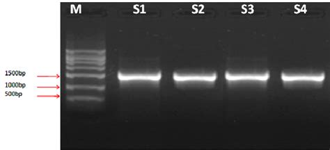 Pcr Amplification Of Bacterial Genomic Dna With 16s Primers S1 S2