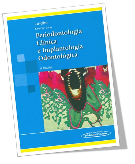 Periodontologia Clinica E Implantologica Odontologica 4ta Edicion