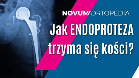 Dlaczego ENDOPROTEZA stawu biodrowego tak dobrze TRZYMA się kości