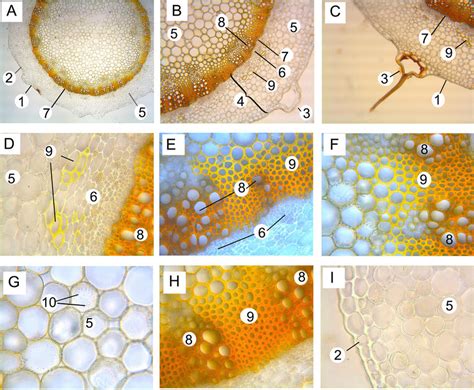 A I Stem Cross Section 1 Cuticle 2 Epidermis 3 Trichome 4