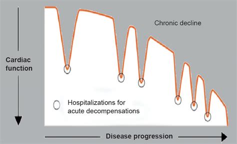 Understanding Hospitalization In Patients With Heart Failure