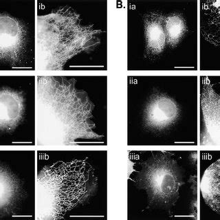 The CAAX Motif Targets Proteins to the Endomembrane System (A) COS-1 ... 