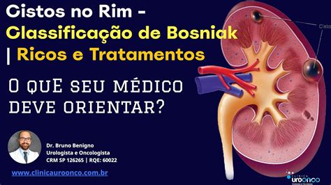 Cisto Renal Bosniak E Malignidade Vista Entenda Os Fatos E