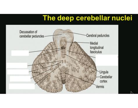 Nuero2: Deep cerebellar nuclei Quiz