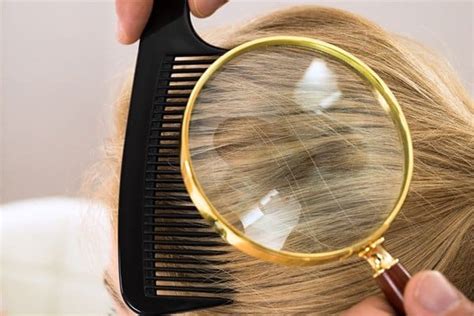 Pictures Of Lice Nits In Blonde Hair | Blonde Hair