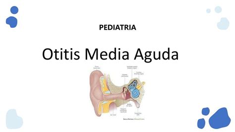 Otitis Media Aguda En Pediatr A Pasionmedicina Udocz