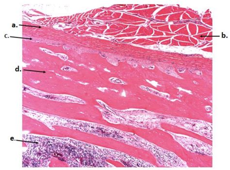 Cancellous Bone Histology Diagram | Quizlet