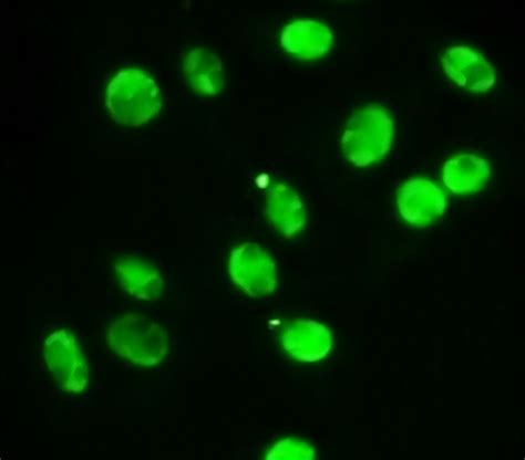 Stat Monoclonal Antibody Irm Ireal Biotechnology Inc