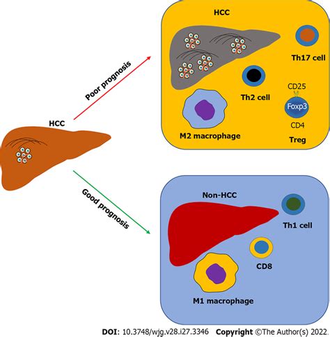 The Alteration Of Intrahepatic Immunity Predicts The Prognosis Of