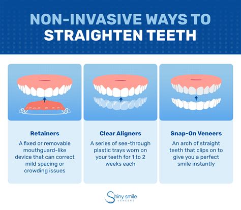 Ways To Straighten Teeth Without Braces