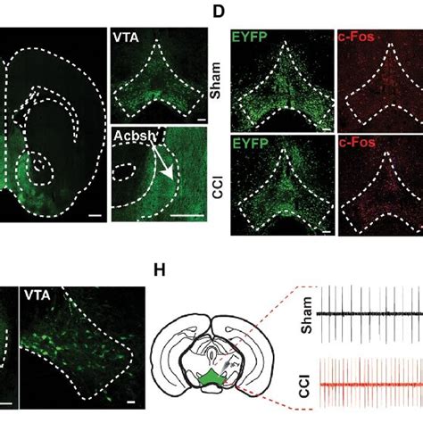 Pdf Vta Nac Glutaminergic Projection Involves In The Regulation Of