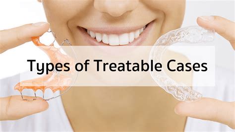 Types Of Retainer About Tooth Dental Clinic