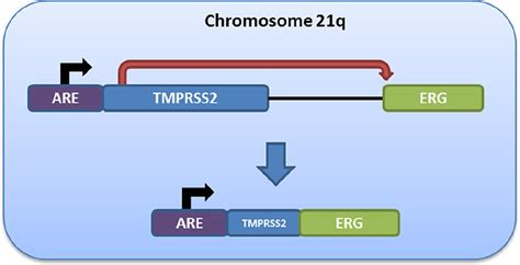 Schematic Of Androgen Driven Erg Expression Following Tmprss Erg