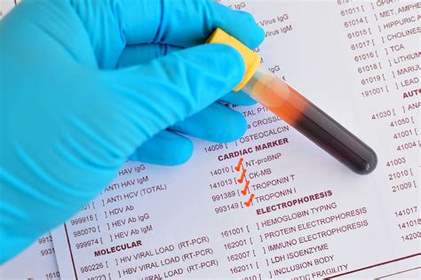 Understanding The Hs CRP Blood Test And Related Factors