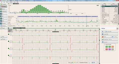 Kardiologia I Spirometria Btl Cardiopoint Holter H Ppcito Pl