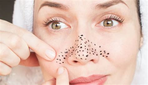 2 Diy Pore Strip Methods For Blackheads