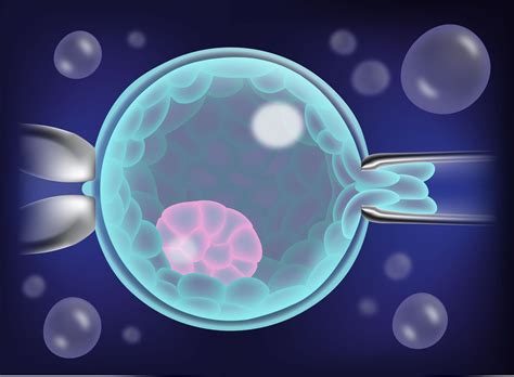 Pre Implantation Genetic Testing Merrion Fertility Clinic