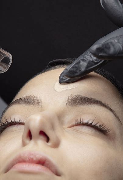 Microneedling Soin Du Visage Soin Du Visage Nouvelle Technologie SRB