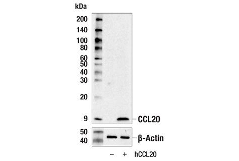 Ccl E J K Rabbit Mab Cell Signaling Technology