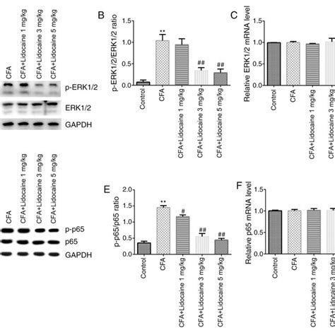 Effects Of Lidocaine On The Mapk Erk Nf B Signaling Pathway In