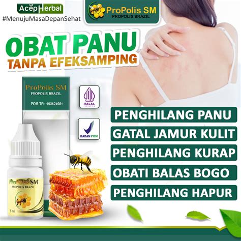 Jual Salep Panu Obat Panu Cair Di Wajah Anak Dan Dewasa Penghilang Panu