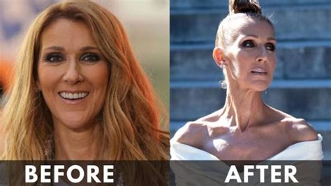 Celine Dion Weight Loss 2024 Before And After Journey