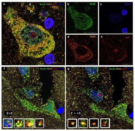 Immunostaining For Neuronal Mitophagy With P As A Specific Mitophagy