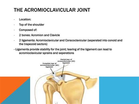 PPT - ACROMIOCLAVICULAR JOINT INJURIES - SHOULDER SEPARATION PowerPoint ...