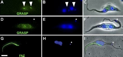 Rnai Knockdown Of Bilbo1 Induces Loss Of Basal Bodymediated Golgi