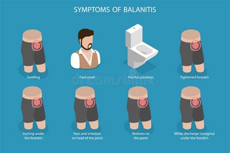 3D Isometric Flat Vector Illustration Of Symptoms Of Balanitis Stock