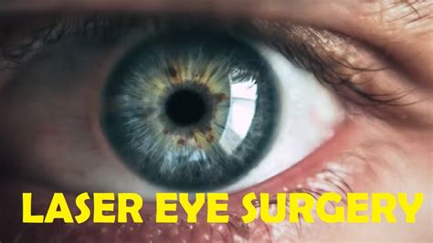 Does Laser Eye Surgery Permanently Fix Eyesight Youtube