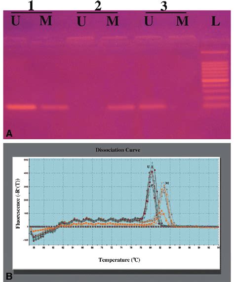 A Representative Agarose Gel Electrophoresis 1 And 2 Represent