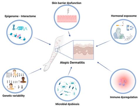 Jcm Free Full Text Intrinsic Effects Of Exposome In Atopic